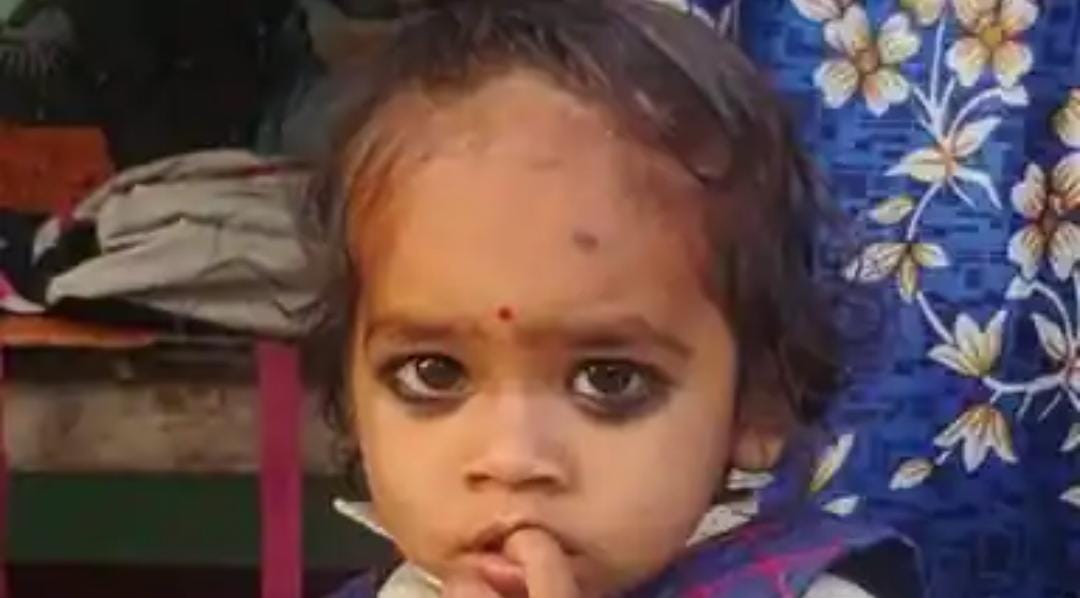 Innocent Child Falls into Boiling Syrup; The Light of the Home Is Extinguished