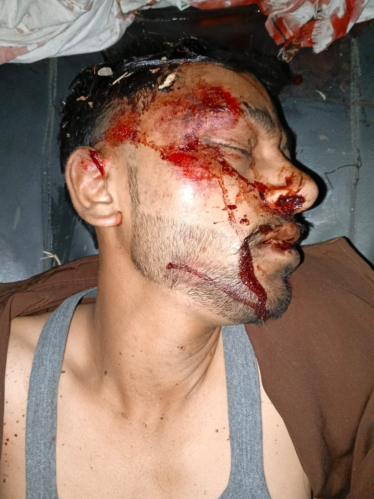 Bike rider dies after colliding with Nilgai, companion critical