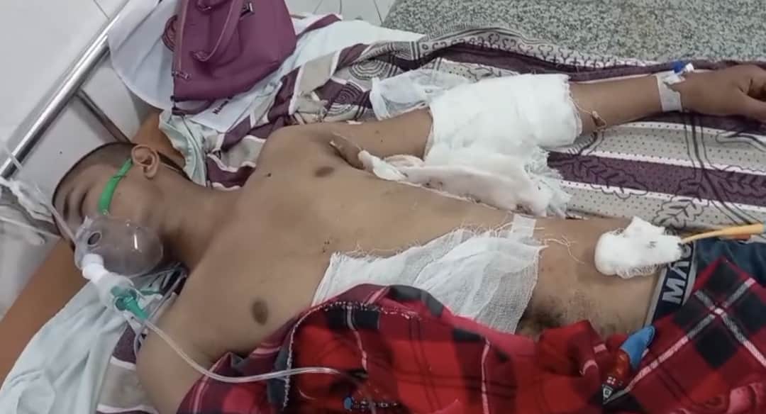 बीआरडी मेडिकल कॉलेज में भर्ती दीपराज।स्रोत-सोशल मीडिया