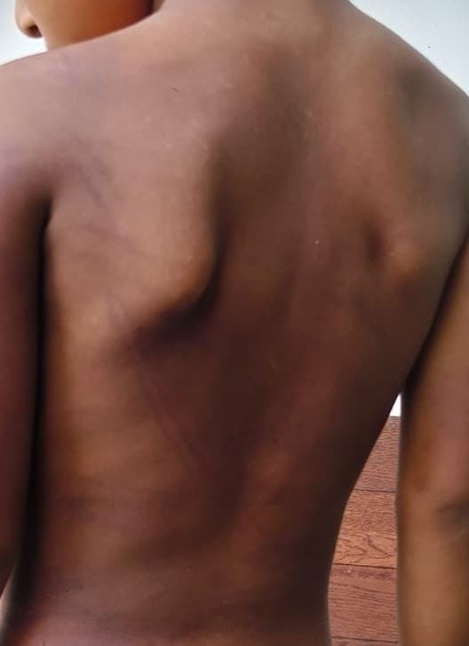 Allegations of Assault on a Minor at a Private Gurukul in Karnal; Complaint Filed with Police