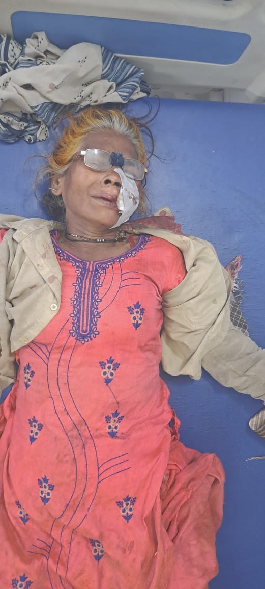 Old woman seriously injured in collision with bullet bike, referred to Meerut