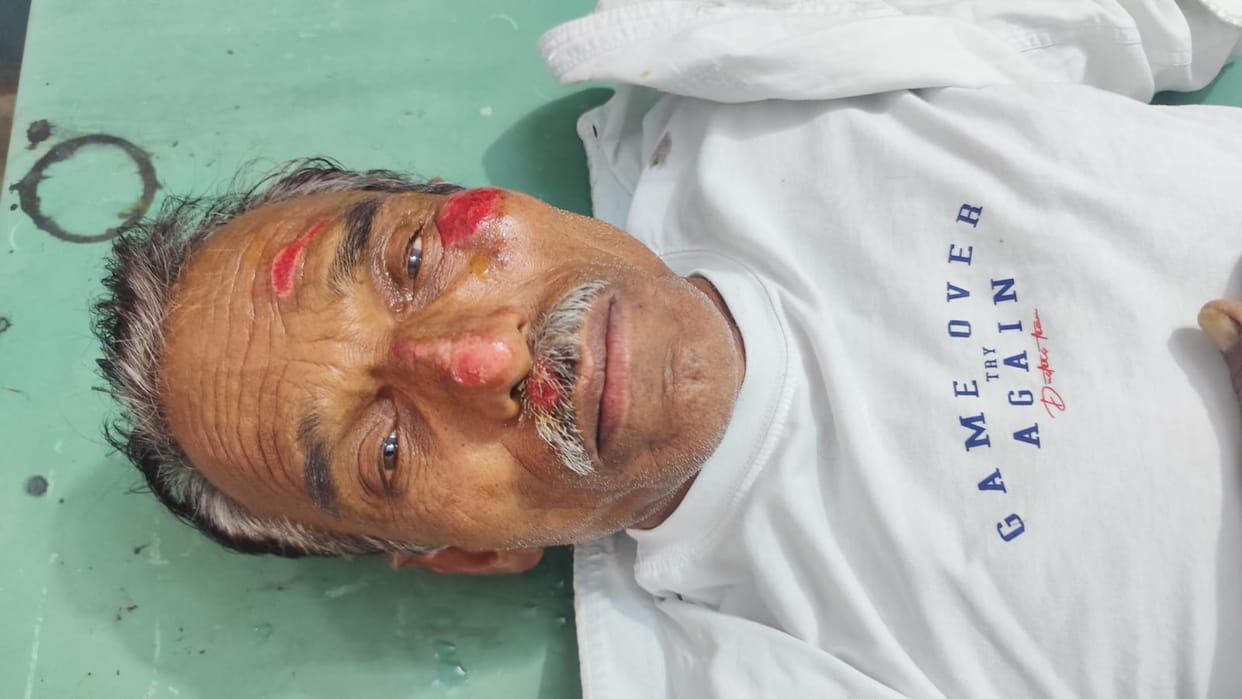 Bike skids while trying to save a dog, three people including an elderly man injured