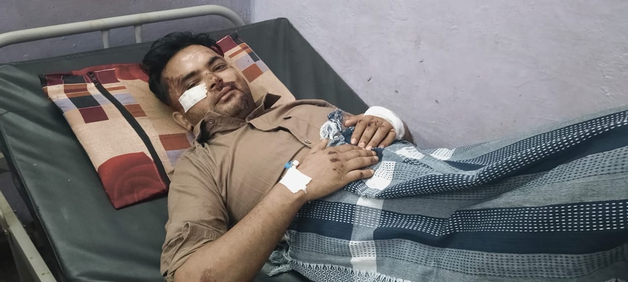 Two bike riders injured after being hit by a speeding truck
