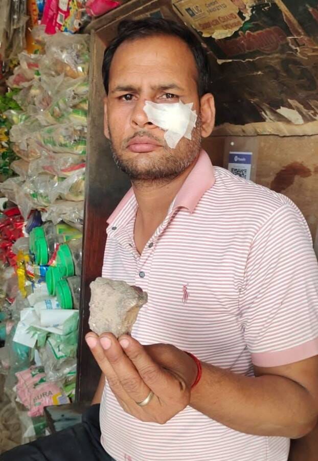 Young man injured after being hit by a stone on an incomplete road