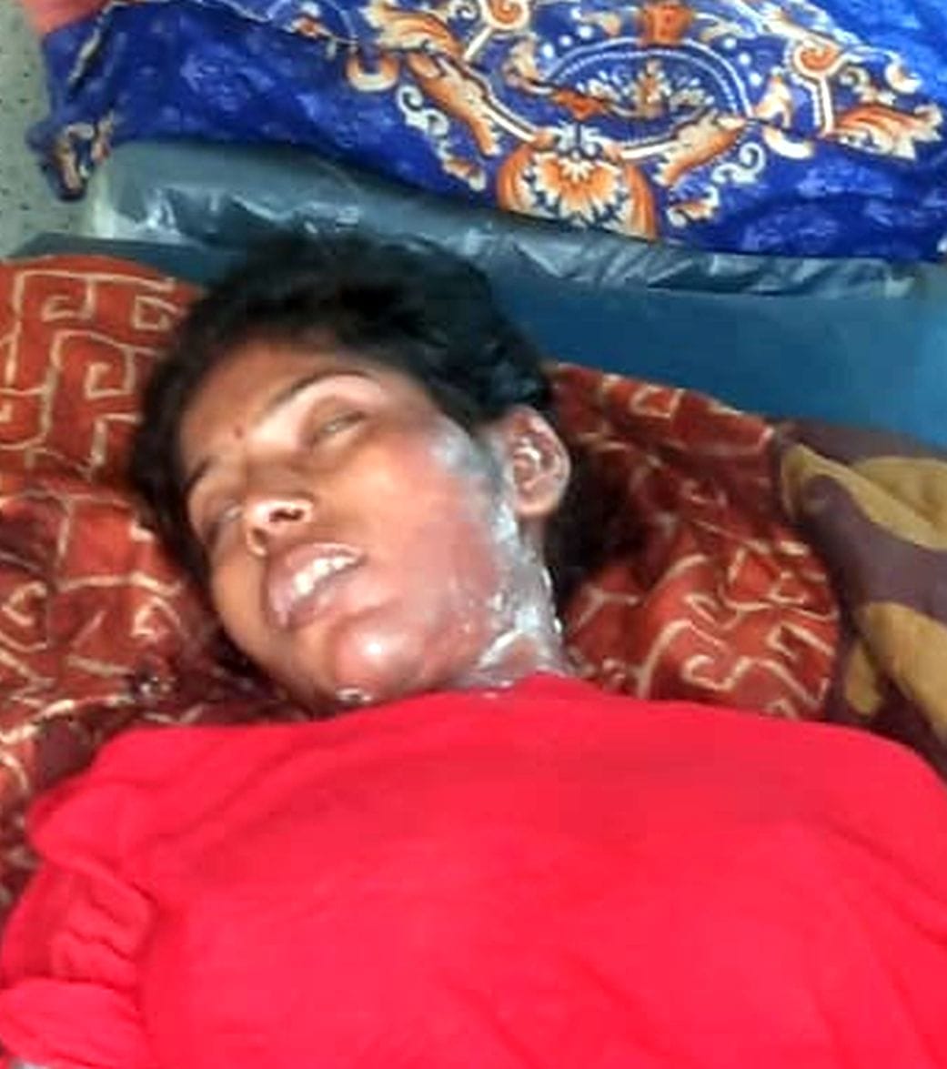 A married woman who had come from her parents' house to her in-laws' house was burnt in a fire.
