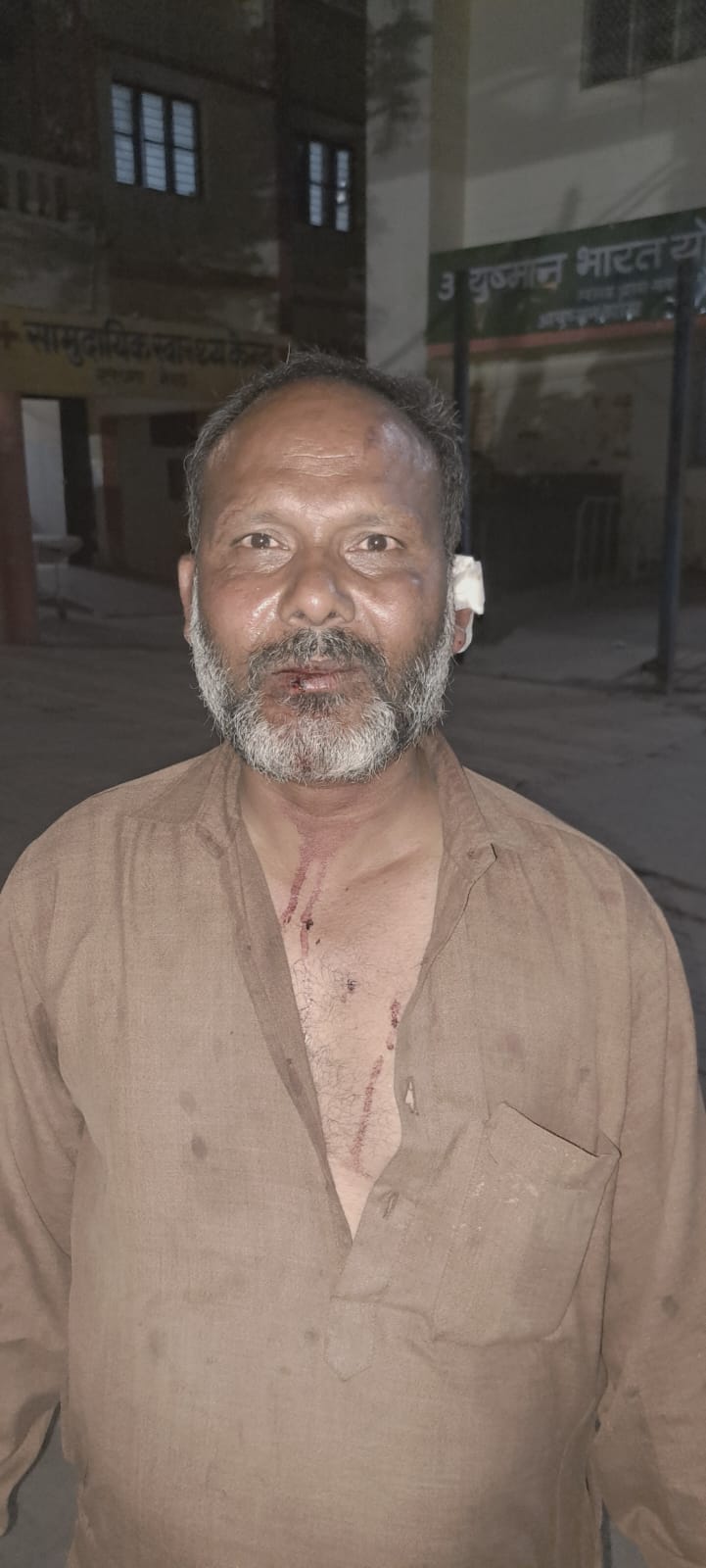 Attack in dispute over snatching of mobile phone, five injured