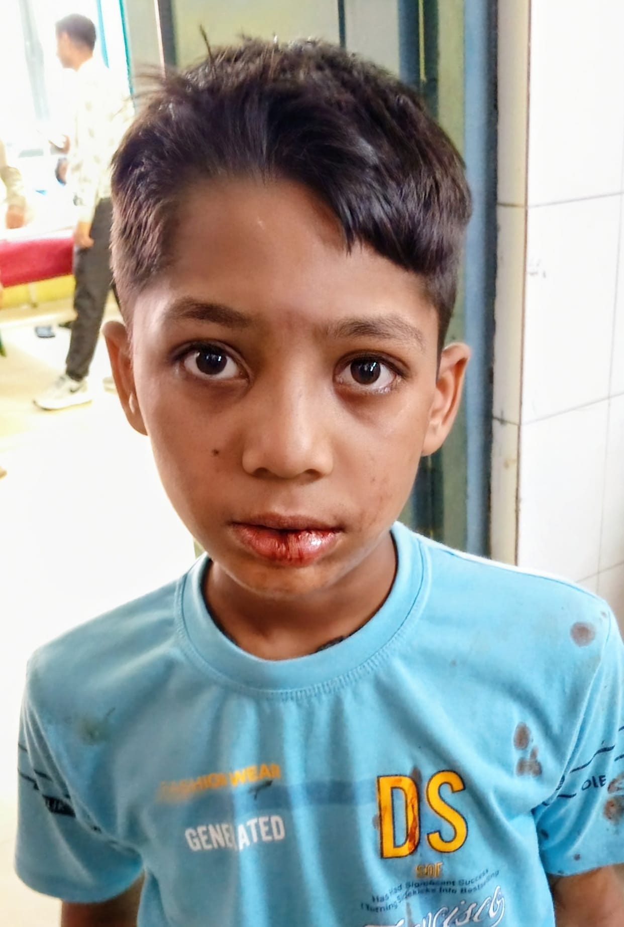 Couple and three children injured in bike collision