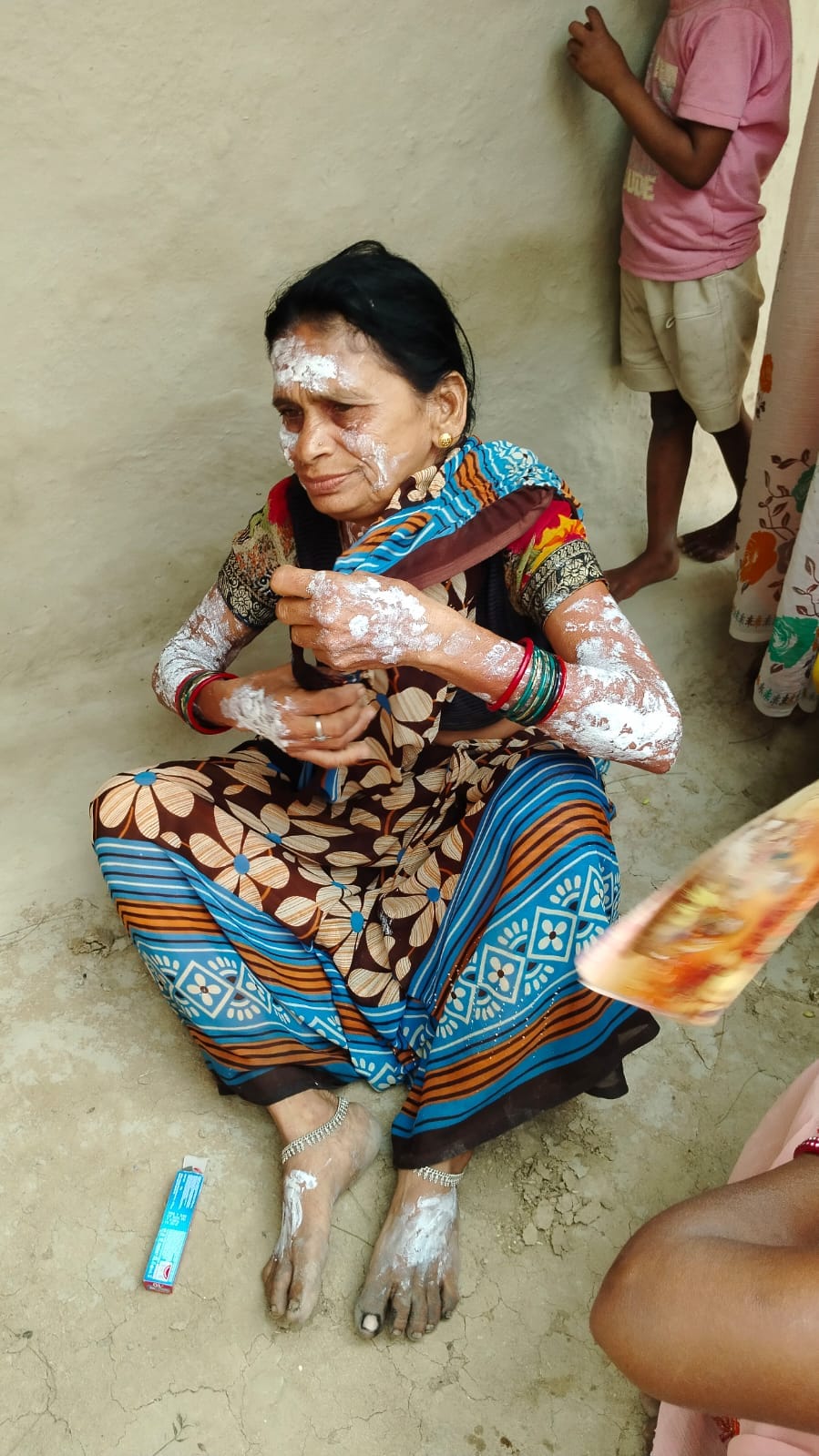 Cylinder explodes while making tea, woman suffers burn injuries