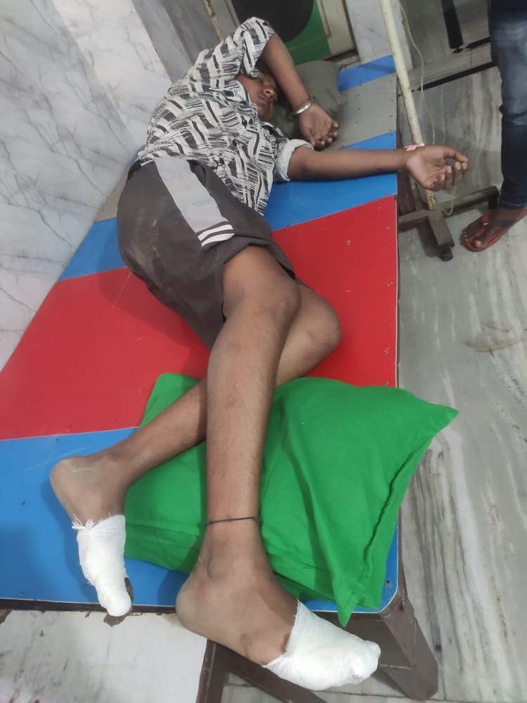 gets scorched after coming in contact with high tension wire