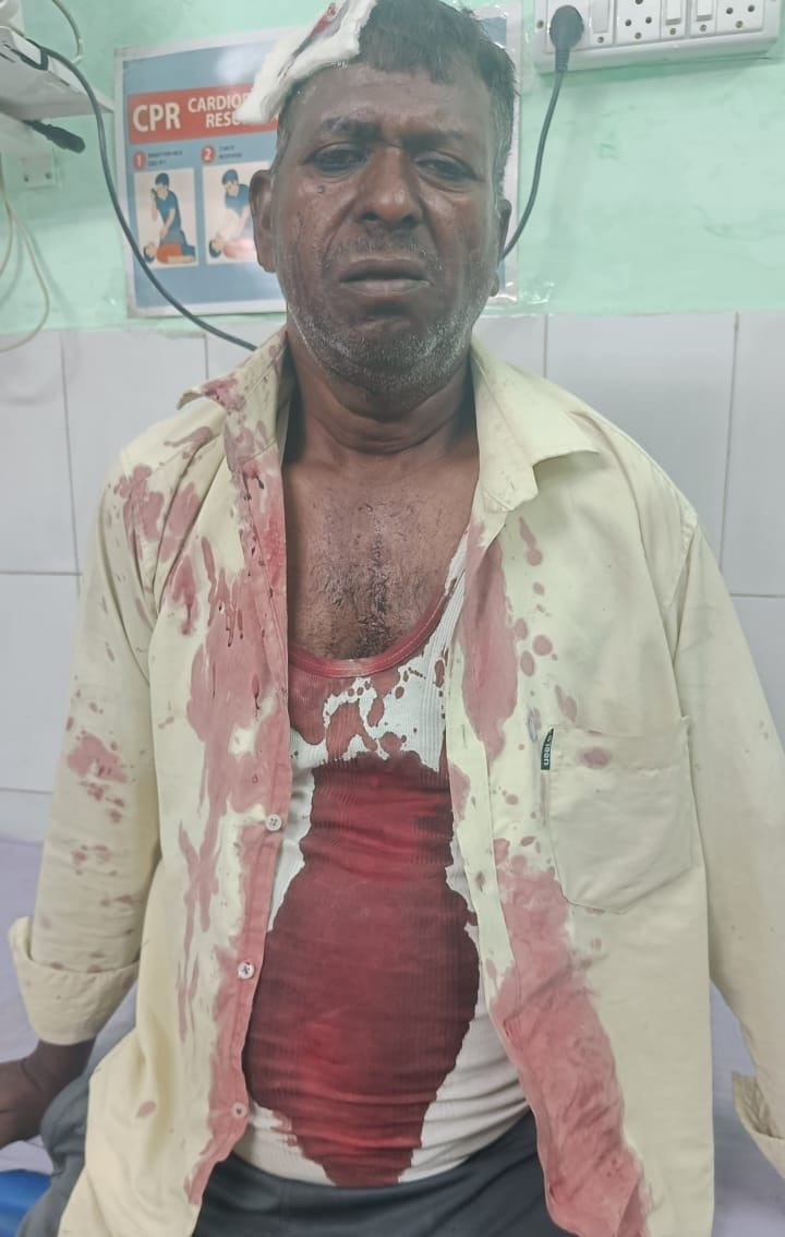 Farmer attacked with a shovel, wife injured