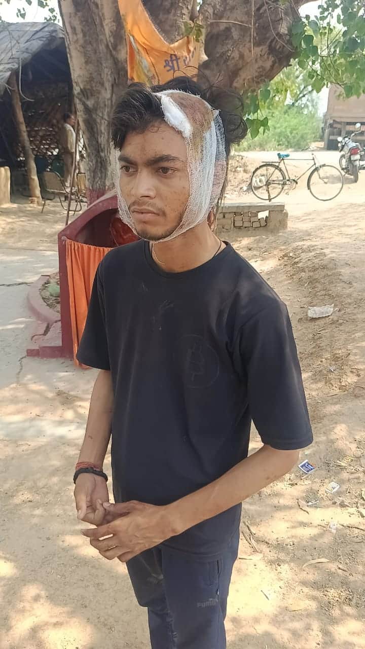 फोटो 03 एचएएमपी 17- घायल मनीष प्रजापति। परिजन