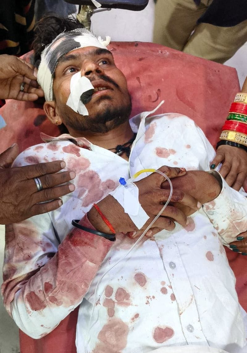 Bike tripping and running at a speed of 100, three killed, injured