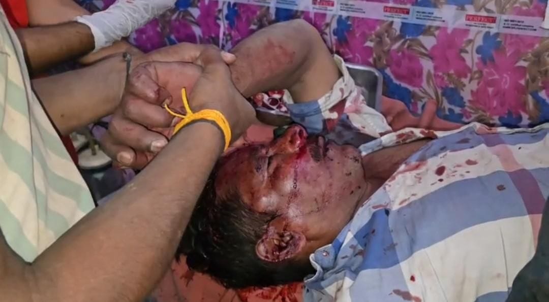 Son attacks father, condition critical