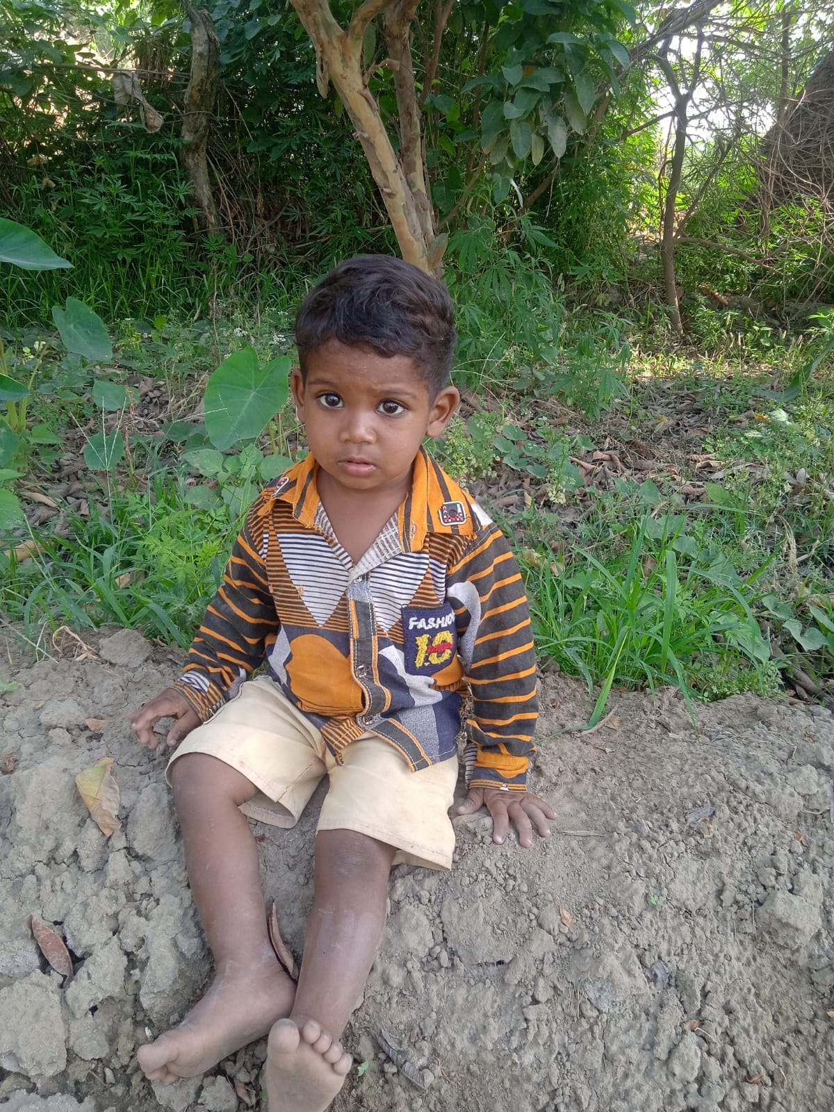 Boy Dies After Balloon Fragment Lodges in Windpipe While Being Inflated