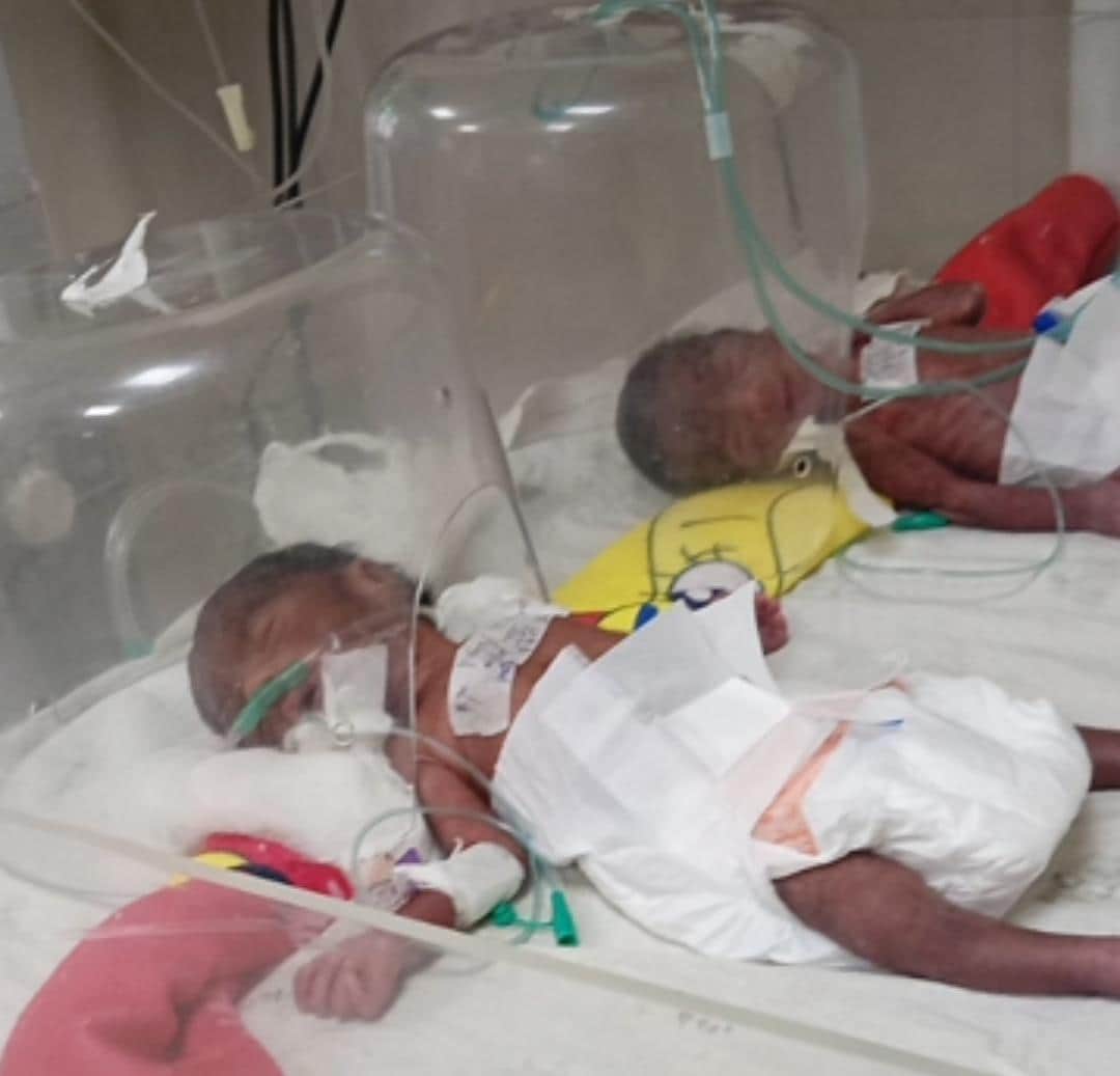 A woman gave birth to four children simultaneously at Sheopur District Hospital, two sons and two daughters