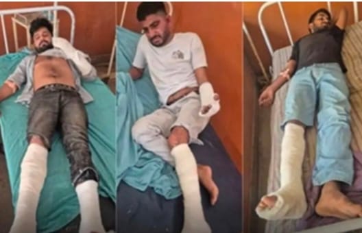 दौसा फायरिंग में घायल बदमाश