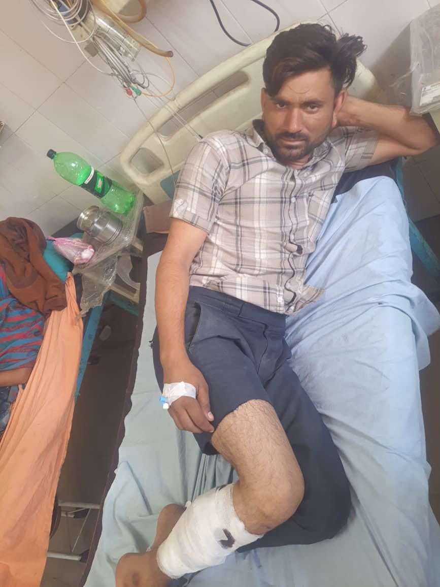 Man injured in encounter with police bullet who snatched necklace from woman's neck, three accomplices also arrested