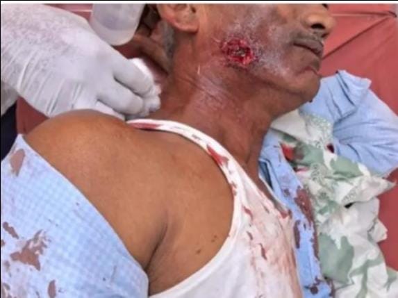 The ration dealer poisoned the Mehndi celebrations... shot the bride's uncle during a road dispute