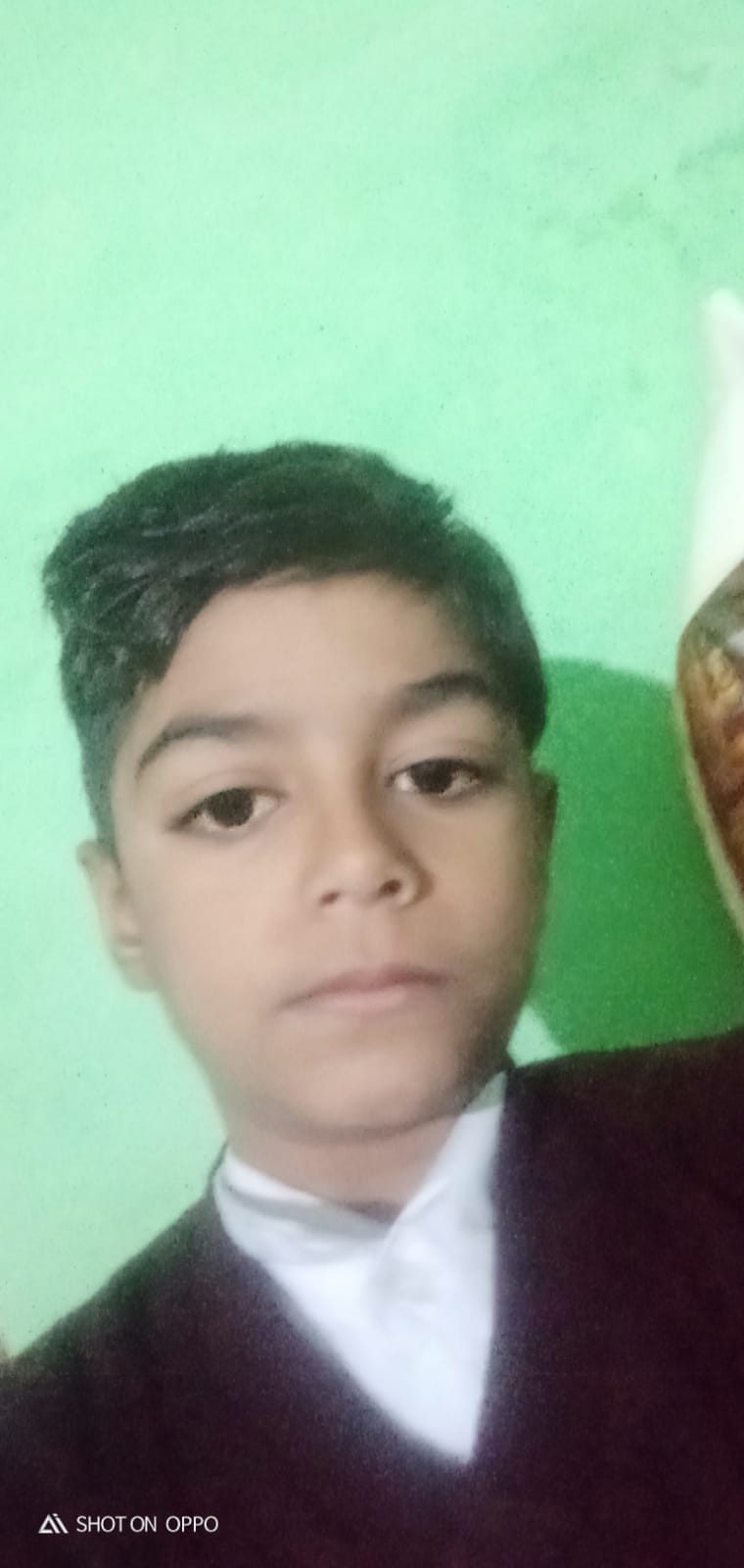 A child who was hit by a high-tension line and suffered burn injuries died during treatment.