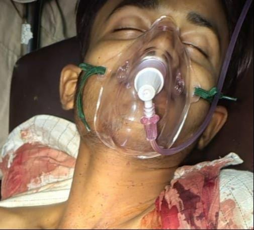 Clash over playing a song on the DJ; bride's maternal cousin shot.