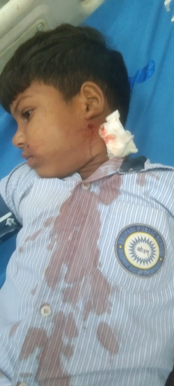 Seven-year-old child critically injured by airgun pellet.