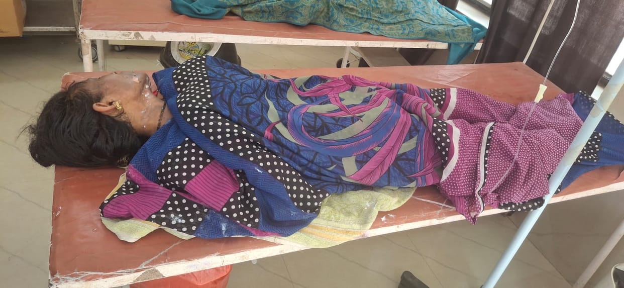 Shamli: Anita, burnt in the fire in Kairana, died in the hospital, two daughters had died nine days ago.