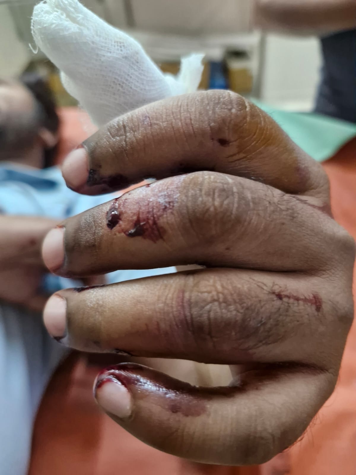 Medical store owner and friend attacked, police arrested two accused