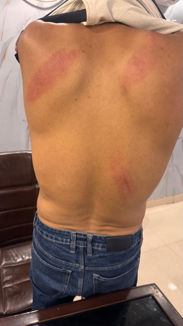 Broker Holds Ambulance Driver Hostage and Beats Him for an Hour, Nepali Patient Writhes in Agony