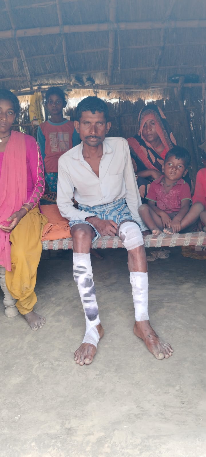 A young man survived a half-hour struggle with a crocodile
