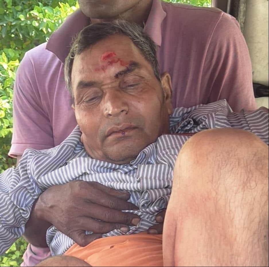 विंढ़मगंज में सड़क हादसे में घायल अशोक विश्वकर्मा।