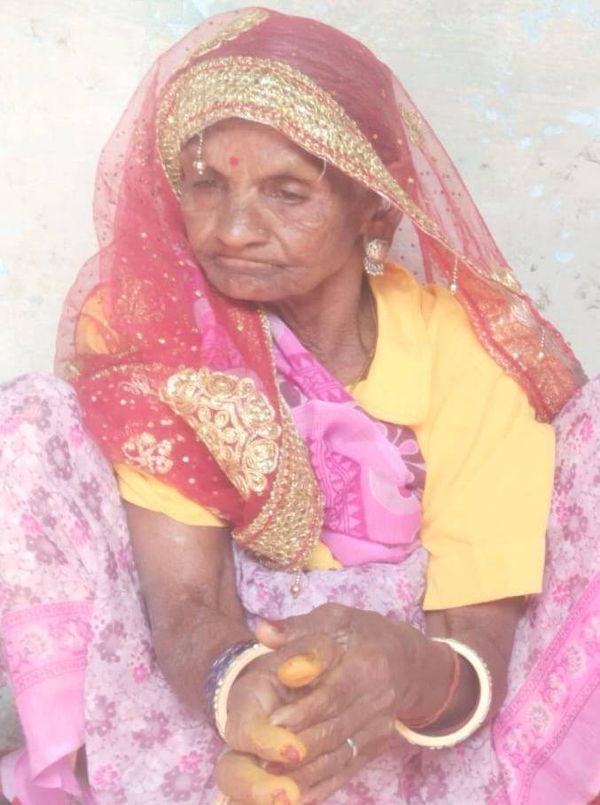 An old woman burning mustard stalks in her field died of burns.