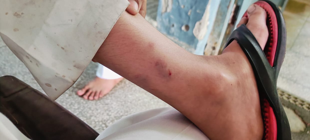 Four devotees injured in monkey attack at Deotsidh temple complex
