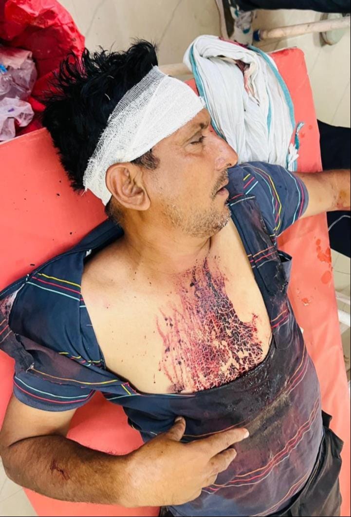 Attack and firing at Khurgan sand mining point, FIR registered against 21