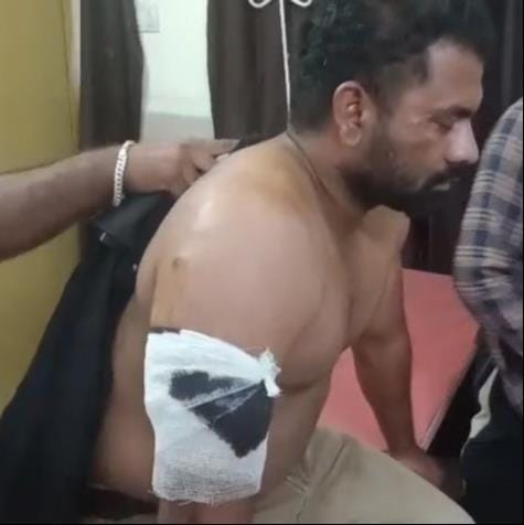 Municipal power lineman beaten, dragged with belt around neck