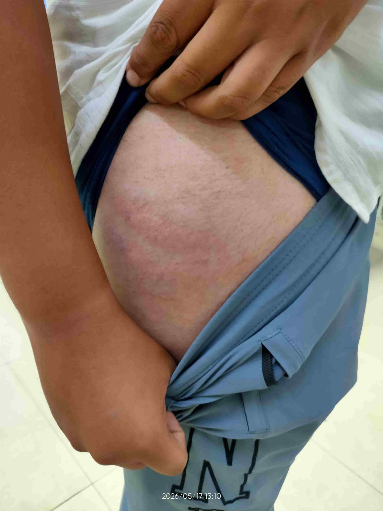 Minor on a bullet bike accused of beating the police, police said - a trick to avoid a challan
