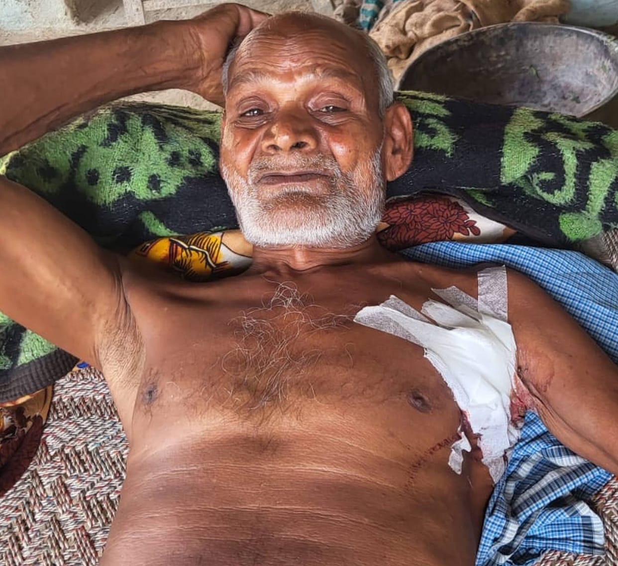 Farmer attacked by bull, horn pierced ribs