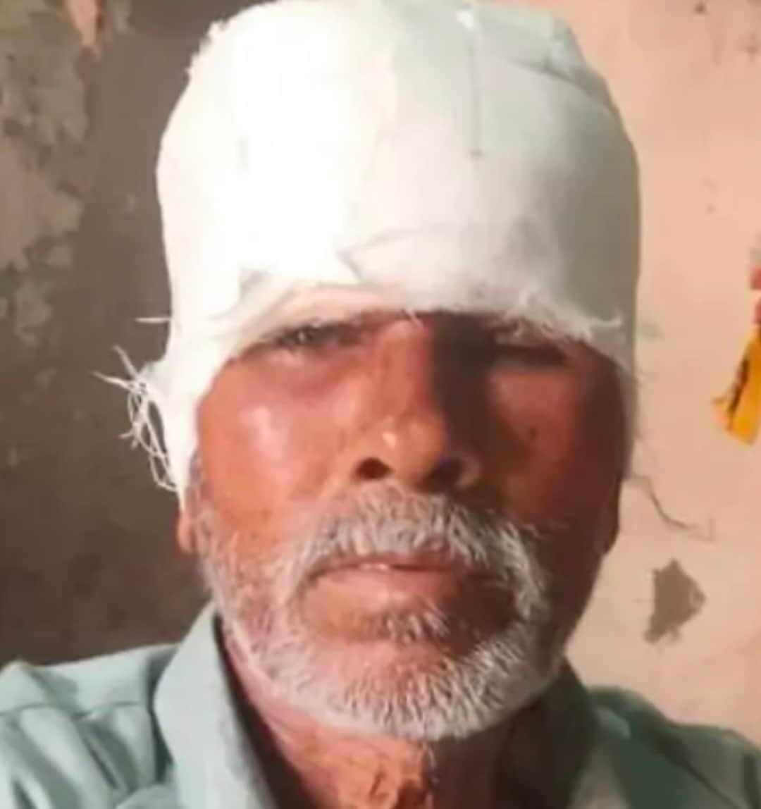 घर के बाहर खड़े बुजुर्ग पर कुत्ते का हमला, माथे से मांस नोचा