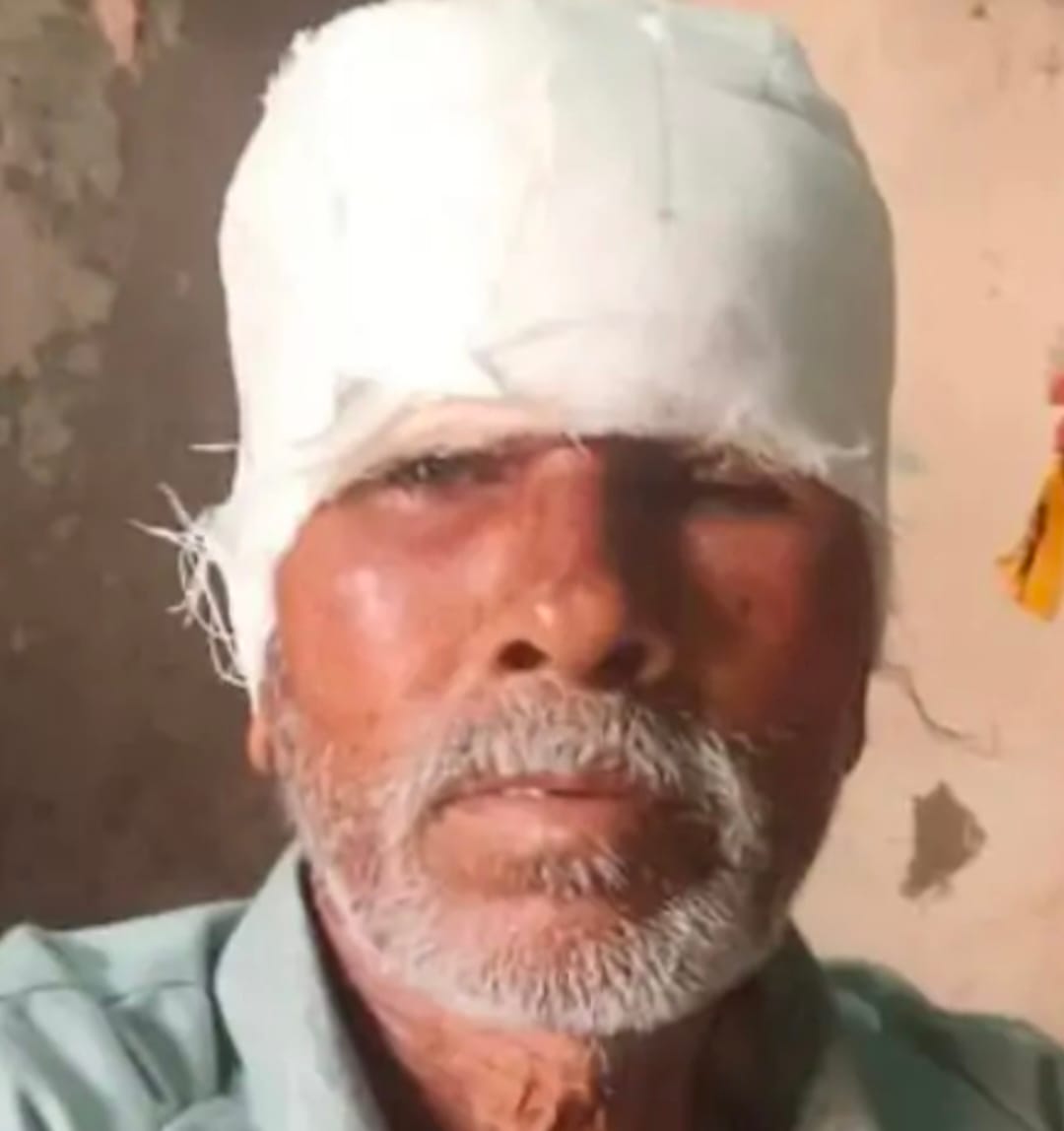 घर के बाहर खड़े बुजुर्ग पर कुत्ते का हमला, माथे से मांस नोचा