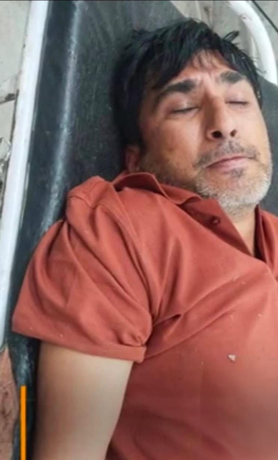 Woman clerk murder accused injured in encounter, arrested