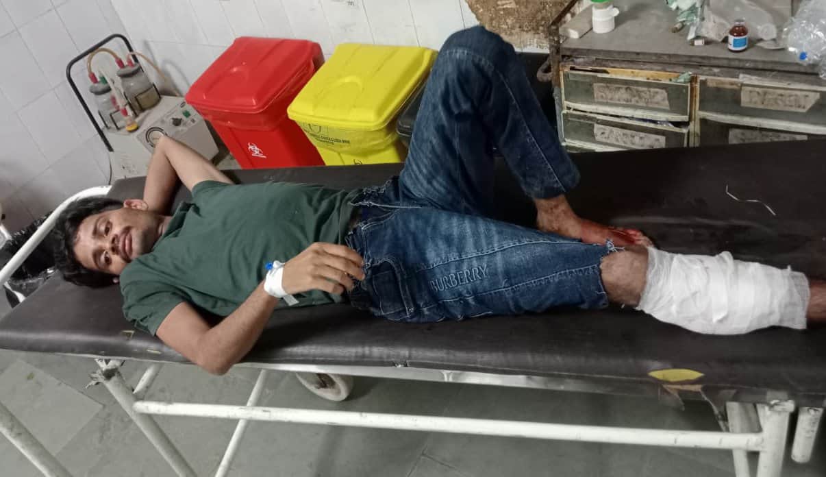 पुलिस मुठभेड़ में घायल दुष्कर्म का आरोपी सोहेल। संवाद