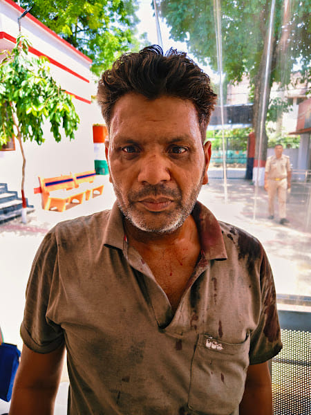 Seven people injured in a bloody clash between two parties over a loan dispute
