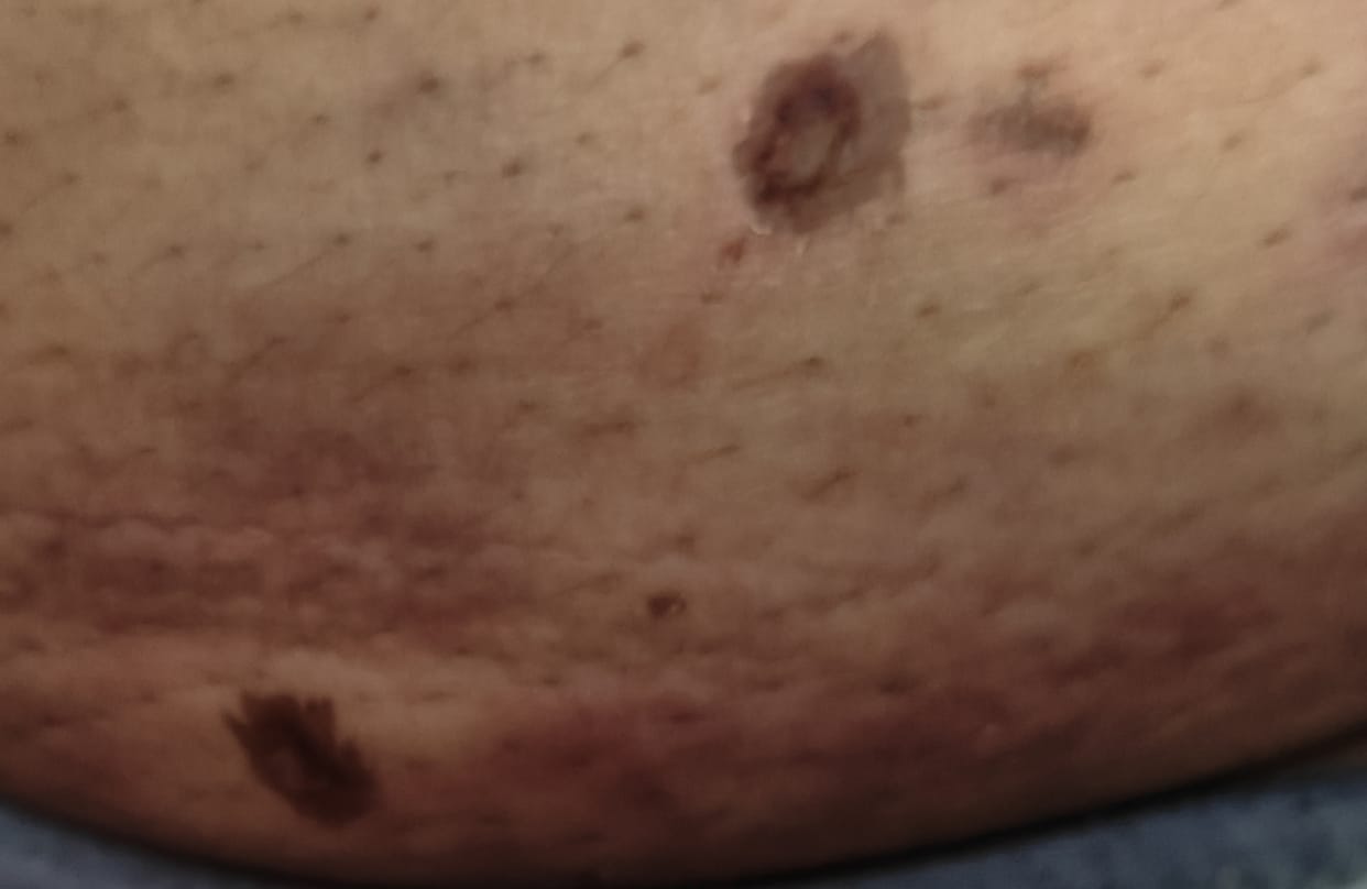 Teacher bitten by pet dog while on census duty