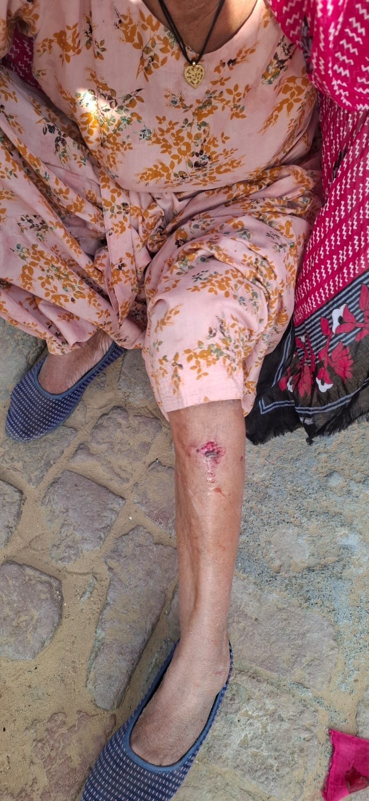 Three women and over 12 cattle injured in fox attack