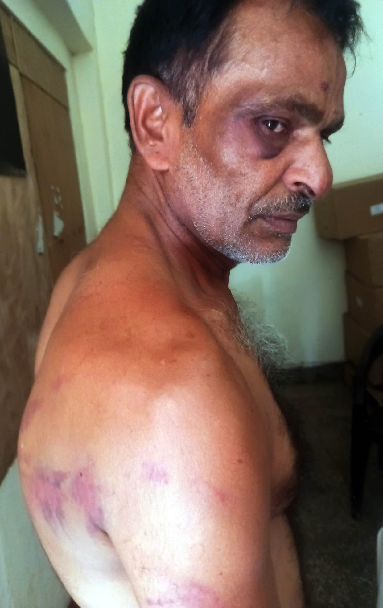 Relative held hostage and beaten with belts and cables