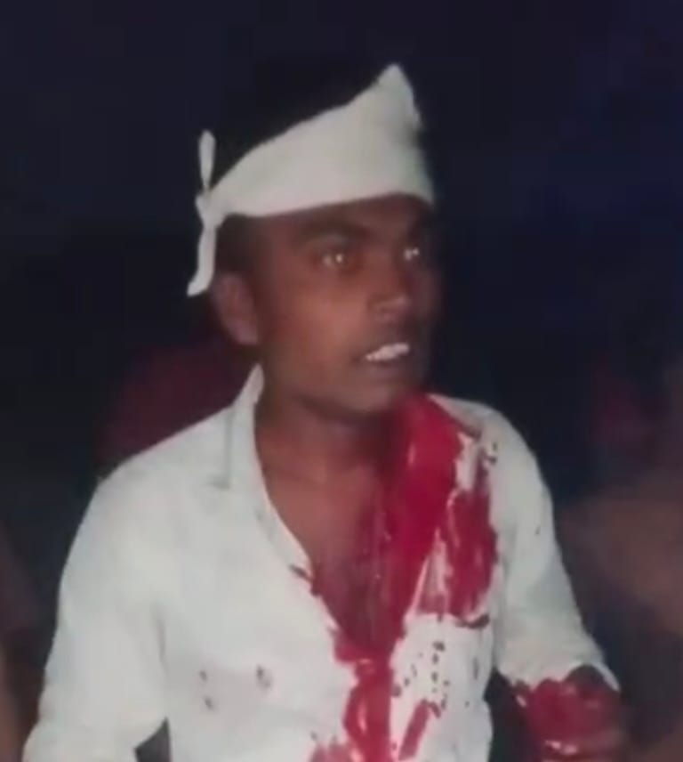 नेवारी में घायल युवक की फोटो