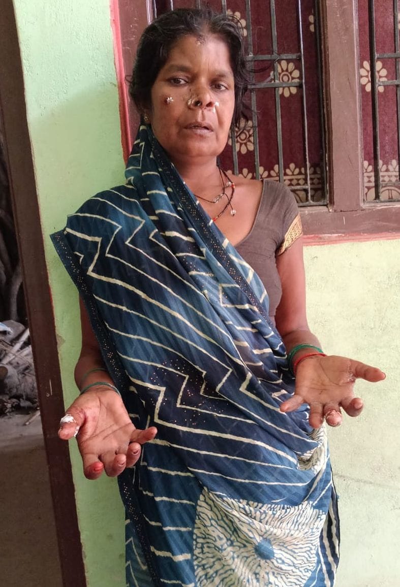 Six Villagers Injured in Jackal Attack; Livestock Also Wounded