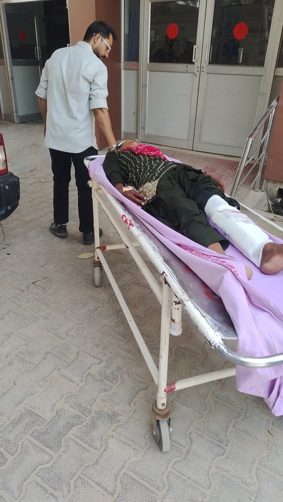 Woman attacked over RTI complaint, leg broken