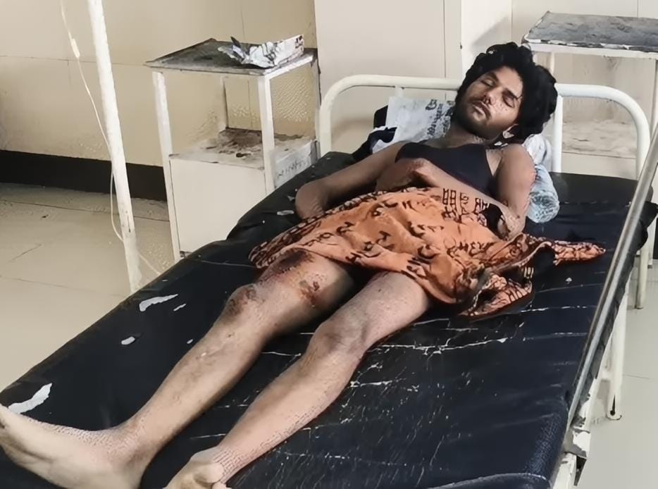 Scorpio Crashes En Route to Sanwaliya Seth, One Dead, Seven Injured