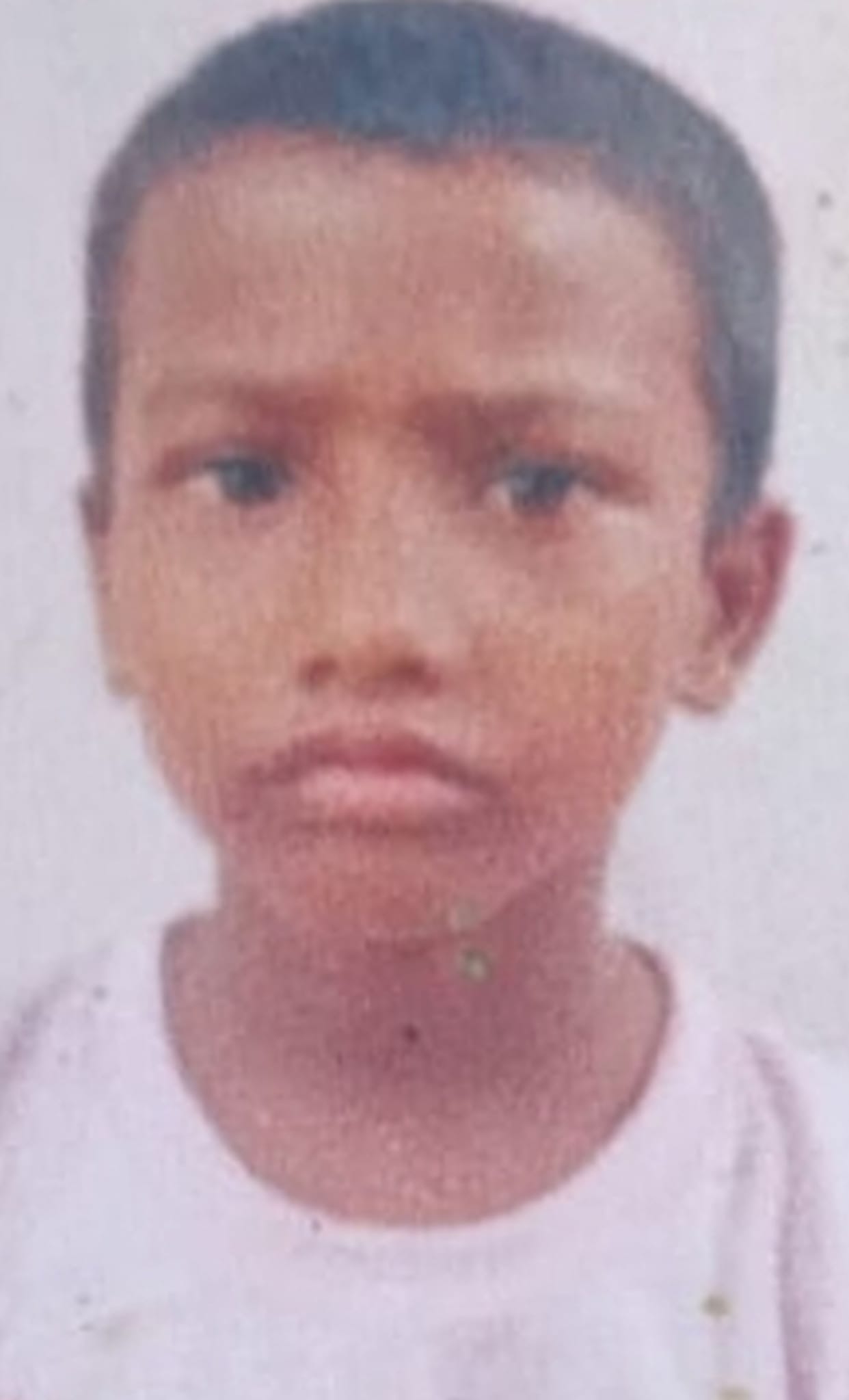 Girl scorched in gas cylinder leak accident succumbs to injuries.