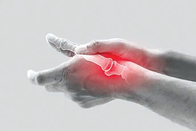 Combination of Ayurveda and modern treatment can be a boon for arthritis patients